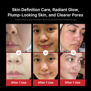 Real user before and after images showing visible glow and clearer pores using Medicube Booster Pro