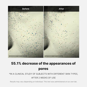 Before and after results showing reduced pore appearance using Medicube Zero Pore One-Day Cream