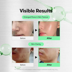 VT CICA Reedle Shot 300 before and after results for pores skin texture and clarity