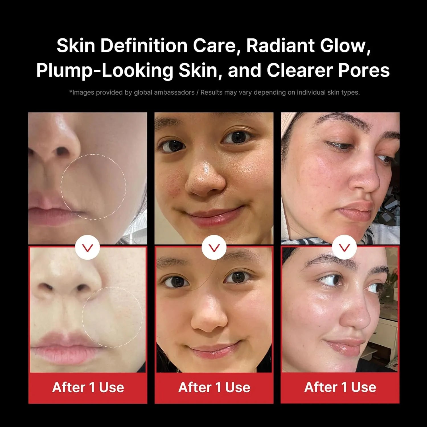 Real user before and after images showing visible glow and clearer pores using Medicube Booster Pro