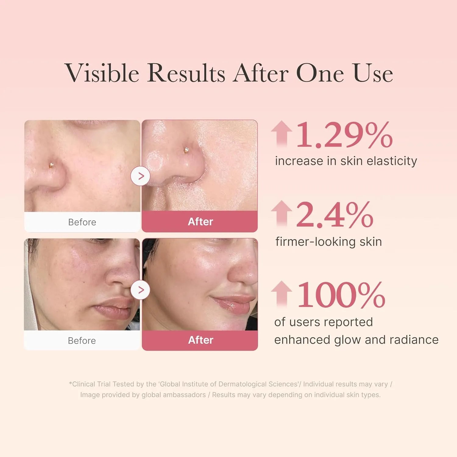 Before and after results of Medicube Collagen Jelly Cream showing improved skin elasticity, firmness, and glow