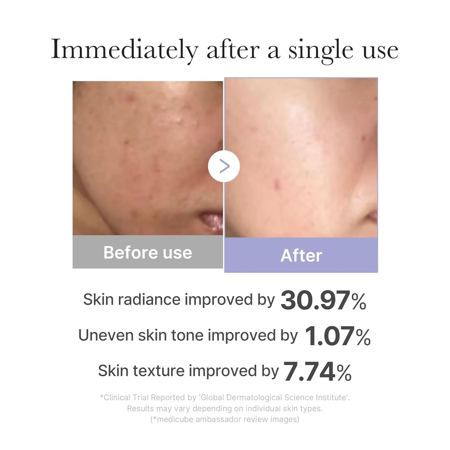 Before and after results showing improved skin radiance, texture, and tone using Medicube Mini Booster Pro